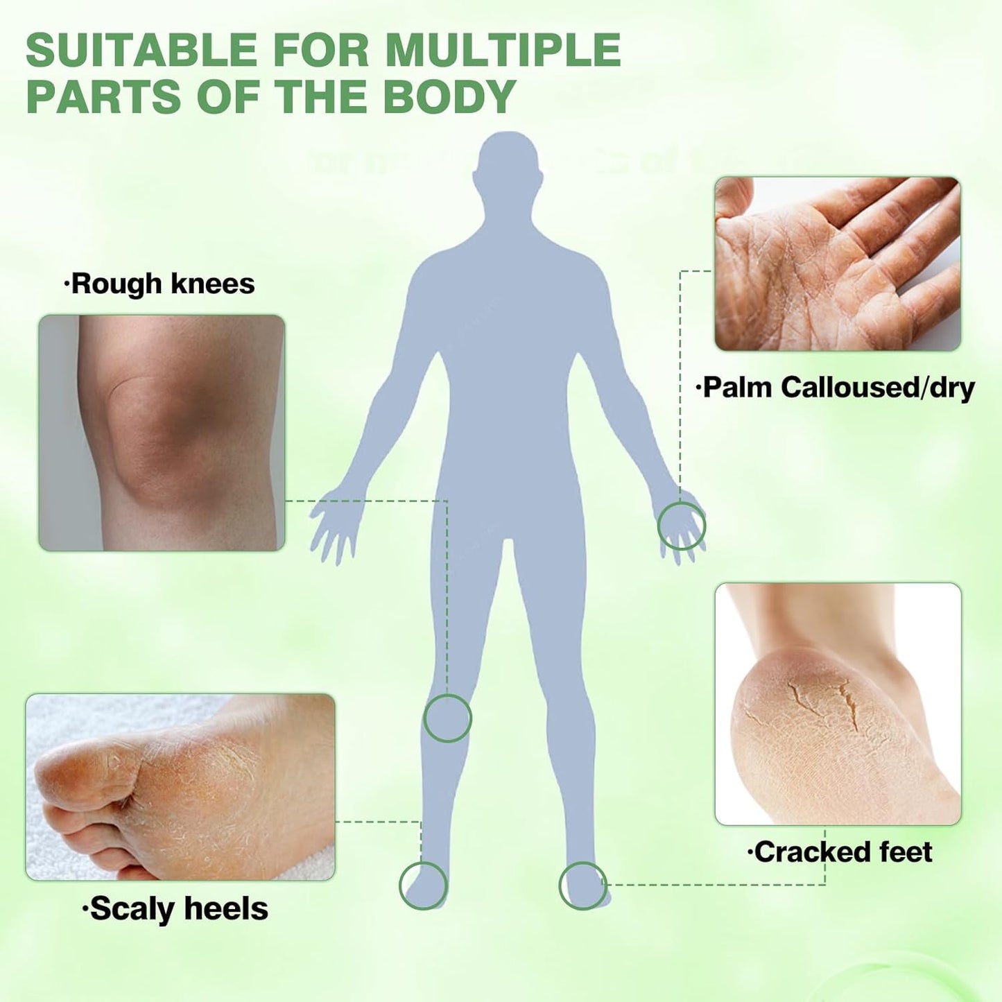 Tea Tree Oil Foot Cream for Dry Cracked Heels and Feet, Ultra-Hydrating Softening Foot Cream, Moisturizes for Healthy Feet, 2.5 oz