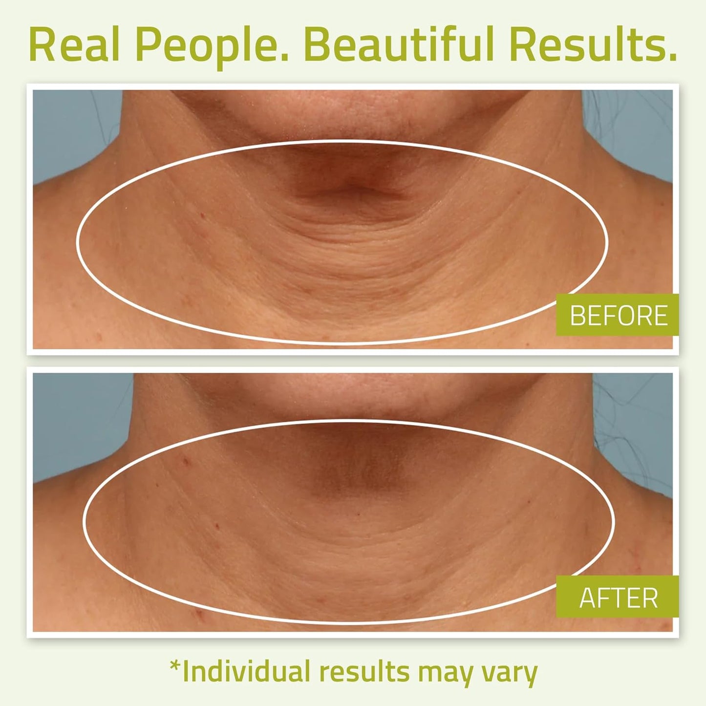 YEOUTH Neck Cream with Vitamin C, Skin Firming Moisturizer for Women and Men, Face and Neck Firming Cream Targets Double Chin, Décolletage, and Chest 2oz