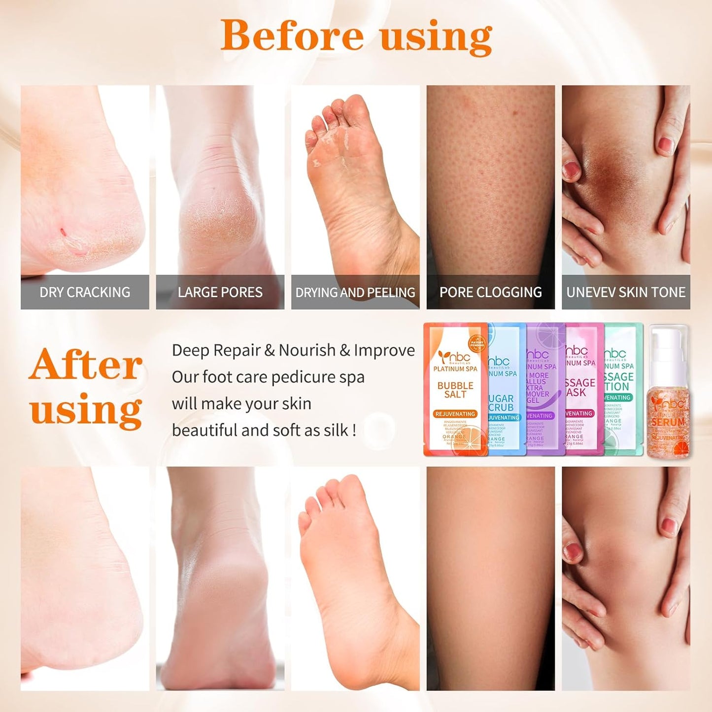 Pedicure Foot Soak Set - Upgraded 6 in 1 Foot Spa, Foot Bath Spa, Pedicure Kit for Tired & Dry Cracked Feet, Athletes Feet, Bad Odor, Softens Calluses (Orange)