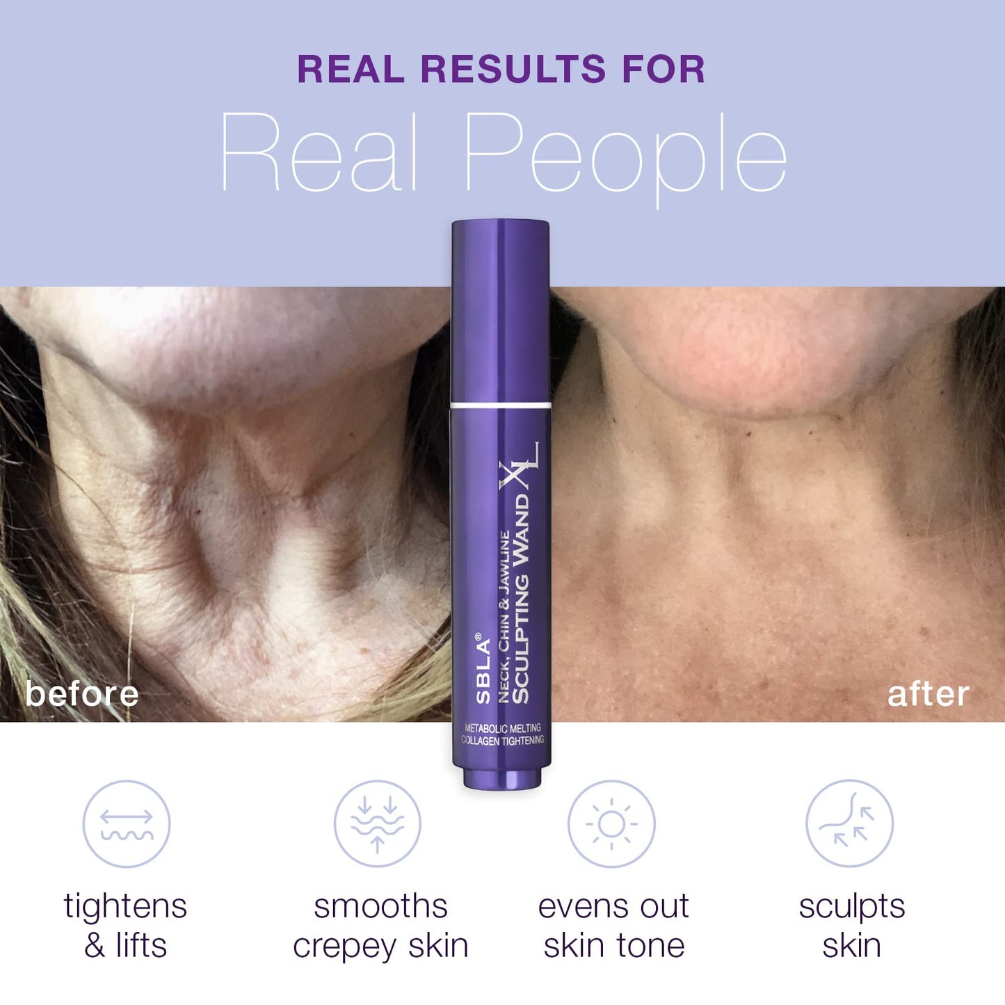 SBLA Neck, Chin & Jawline Sculpting Wand XL – Melts Neck Fat Under The Chin & Along Jowls, Lifts & Sculpts The Entire Area & Reduces Lines, Boosts Collagen Production
