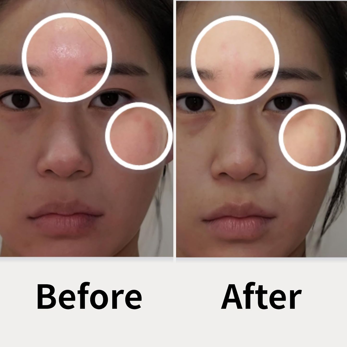 Ato Fast Calming Patch for Skin Redness, Itching & Flare-Ups – Soothing Hydrogel for Sensitive Skin with Cica & Panthenol – 10 Pairs