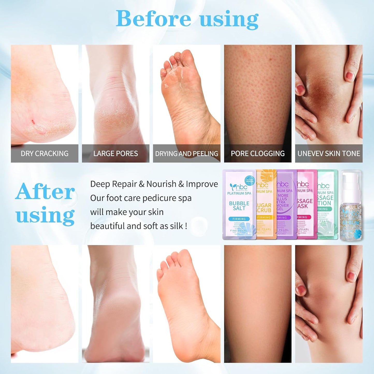 Pedicure Foot Soak Set - Upgraded 6 in 1 Foot Spa, Foot Bath Spa, Pedicure Kit, Foot Soak for Tired & Dry Cracked Feet, Athletes Feet, Bad Odor, Softens Calluses (Pearl)