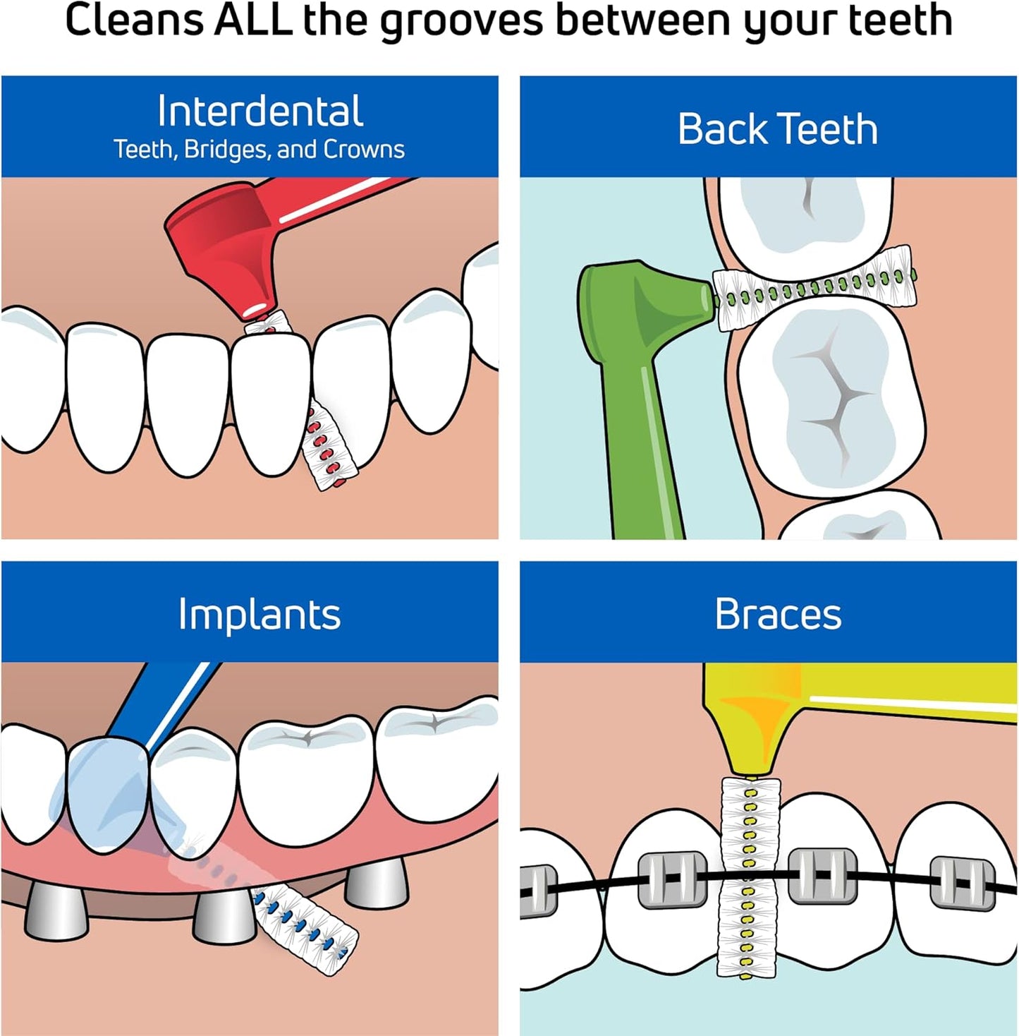 TePe Interdental Brush Angle, Angled Dental Brush for Teeth Cleaning, Pack of 25, 0.5 mm, Extra-Small/Small Gaps, Red, Size 2