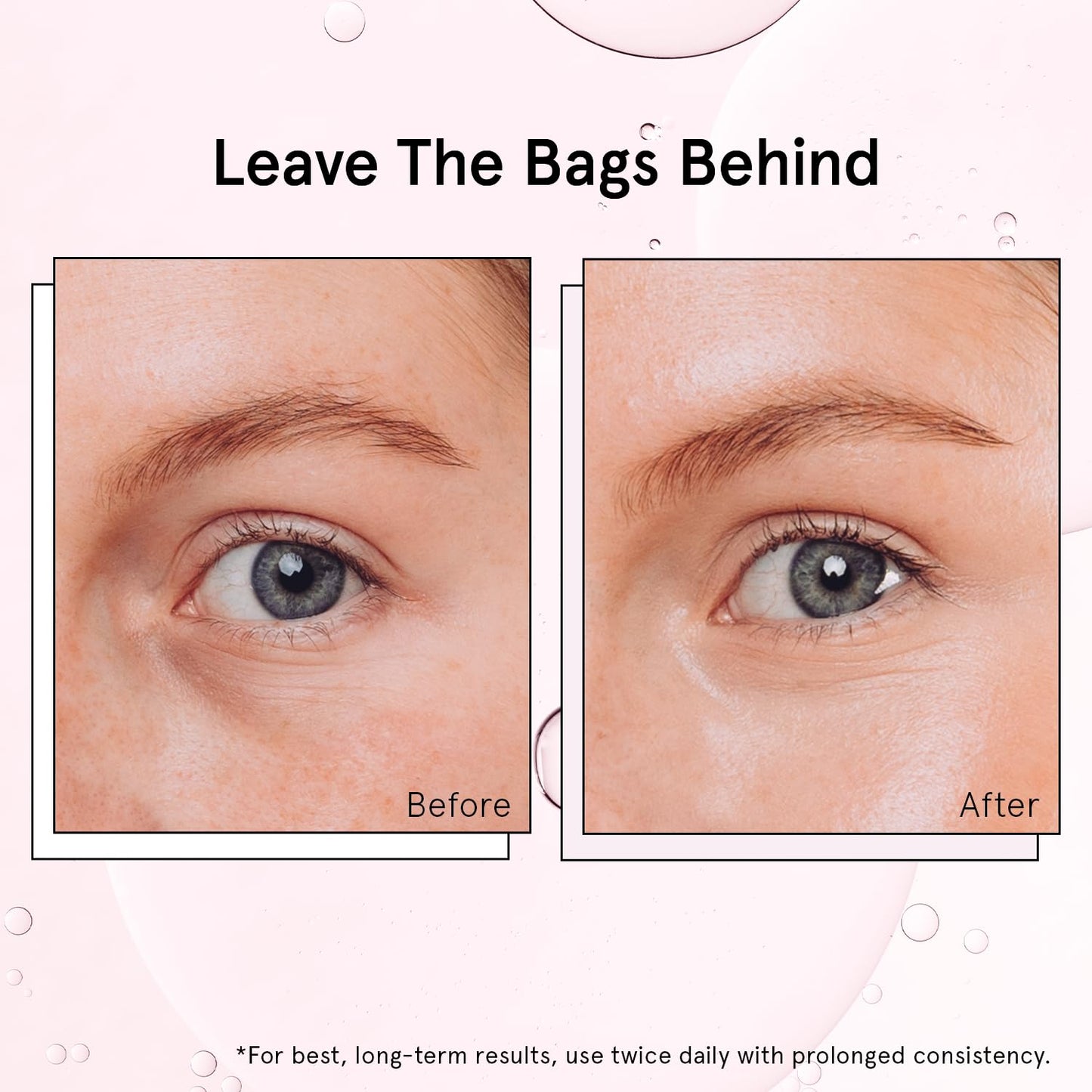 grace & stella Under Eye Brightener Roller - Airplane Travel Essentials - Travel Size Toiletries - Retinol & Caffeine Eye Serum for Puffiness, Dark Circles, Wrinkles - Vegan Skincare (15ml / 0.51floz)