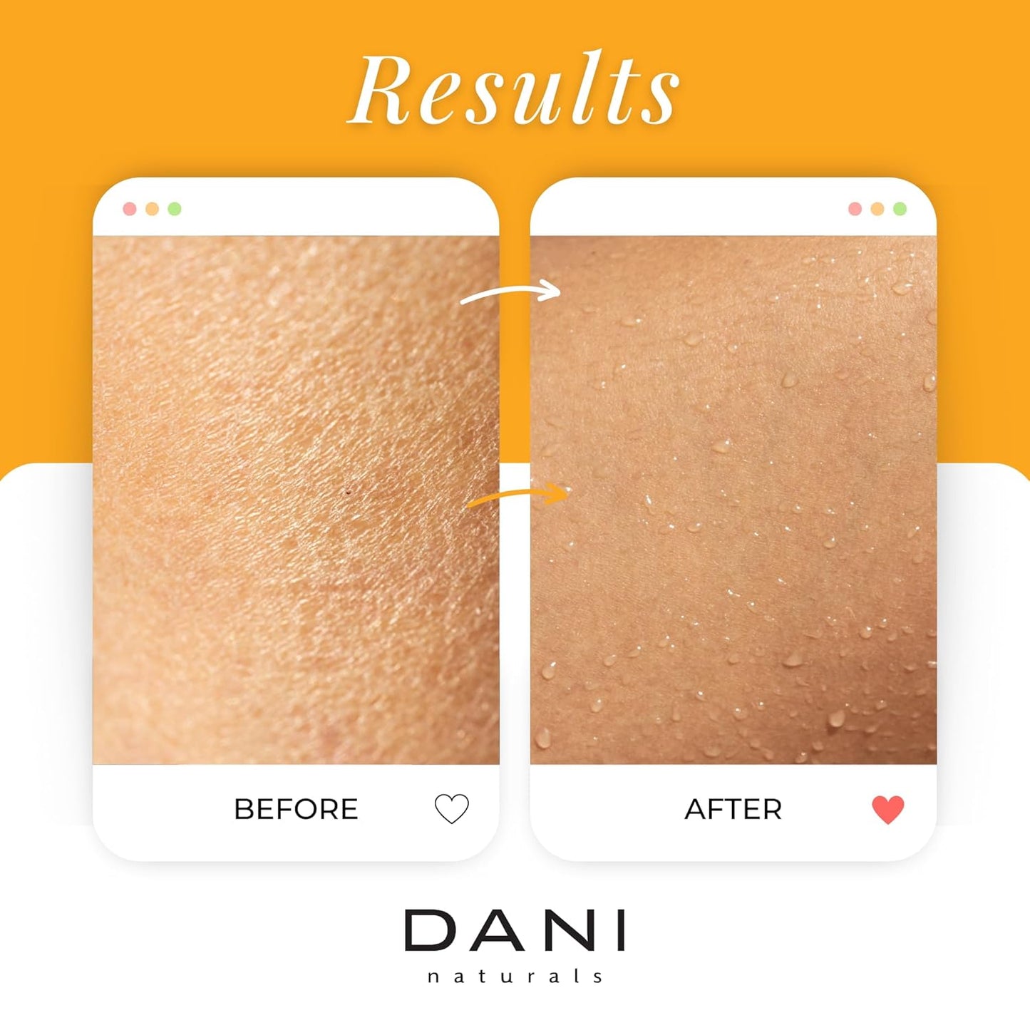 DANI Naturals Sugar Scrub - Gently exfoliates with organic cane sugar, leaving skin soft and radiant. Infused with grapefruit and ginger, it deeply moisturizes. 14 oz