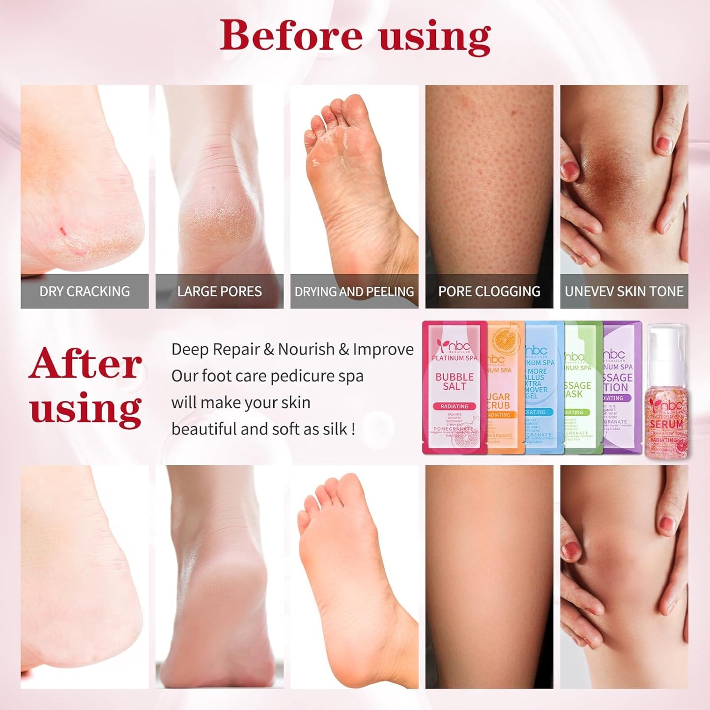 Pedicure Foot Soak Set - Upgraded 6 in 1 Foot Spa, Foot Bath Spa, Pedicure Kit, Foot Soak for Tired & Dry Cracked Feet, Athletes Feet and Calluses (Pomegranate)