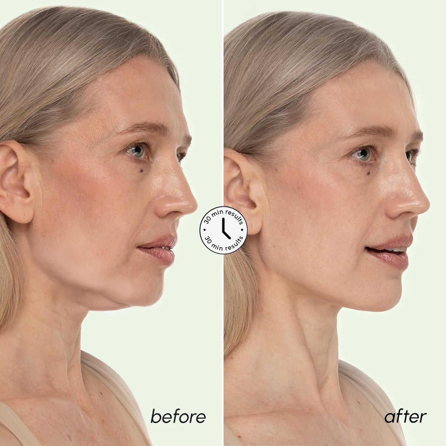 MAREE V Line Lifting Mask with 24K Gold – Deep Collagen Face Mask for Women – Jawline Shaper Mask with Retinol & Hyaluronic Acid – Neck Tightening & Firming - Double Chin Strap for Face Lift