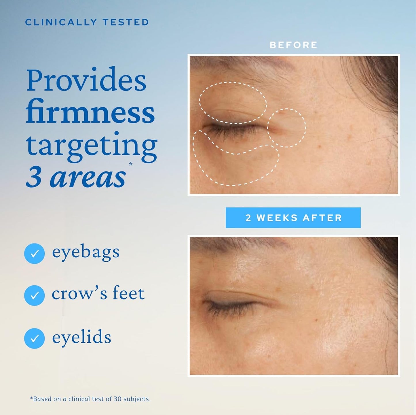 belif Peptide Eye Bomb, Anti-Aging Eye Cream for Wrinkles, Fine Lines, Crow’s Feet & Eye Bags, 48hr Hydration with Ceramide, Squalane, Caffeine, Dermatologist-Tested Korean Skincare, 0.84 fl.oz