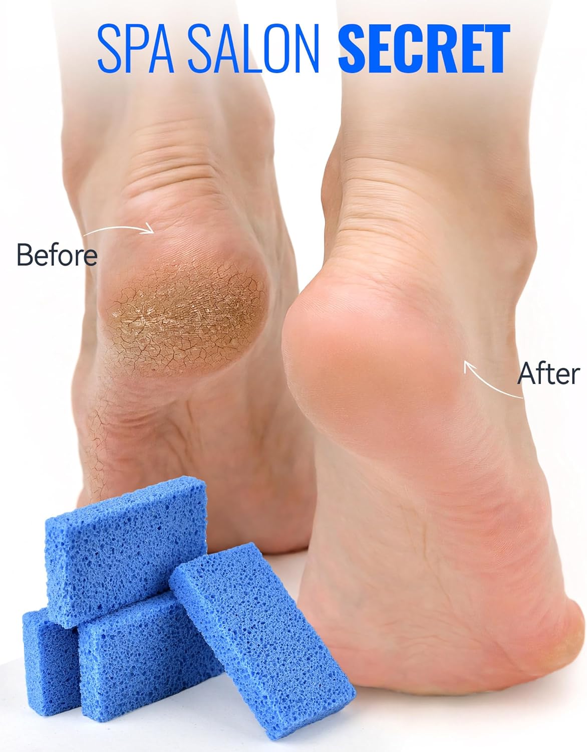 Maryton New Sharper Pumice, Professional Pedicure Tools Foot Scrubber Salon Disposable Pumice Stone Callus Remover for Feet, 40Pcs (Blue)