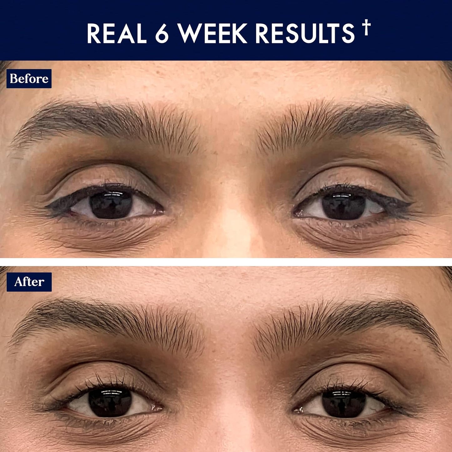 SugarbearPRO BrowCare Vitamin Serum with Peptides MSM and Biotin | Vegan Formula | 3 Month Supply for Fuller Healthier Looking Brows