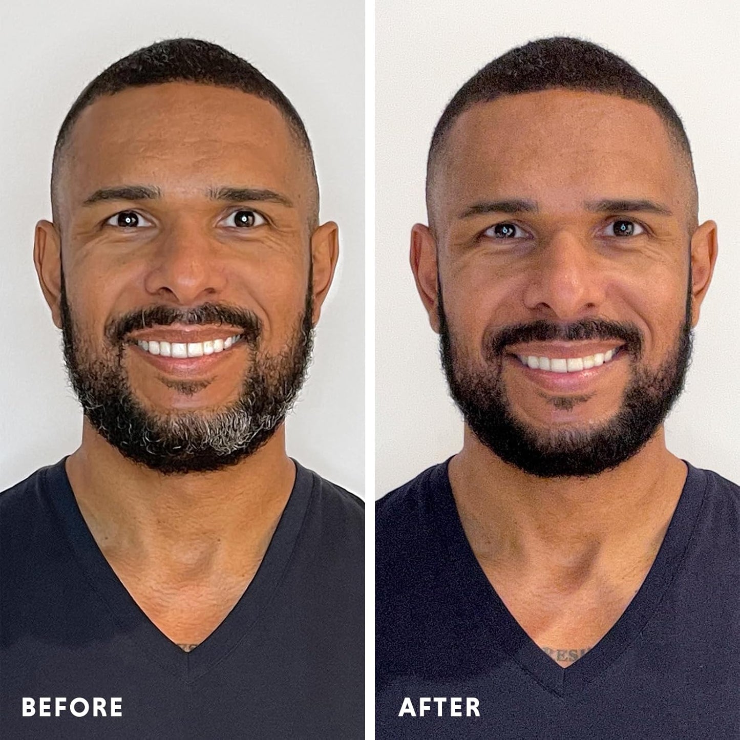 Hair & Beard Color for Full Gray Coverage 2 pack - Medium Golden Copper Blonde - Ammonia-Free Complete Men’s At-home Beard & Hair Dye Kit, Professional-grade Permanent Hair Color (8.34)