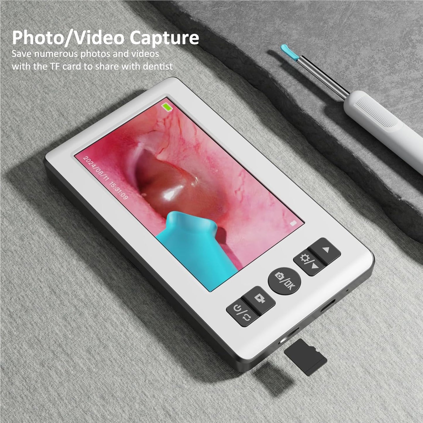 Ear Wax Removal Kit with Camera | Ear Cleaner with 4.3" IPS Display, 1080P HD, 2500mAh Battery, Silicone Tips | Standalone Tool, No Phone Required