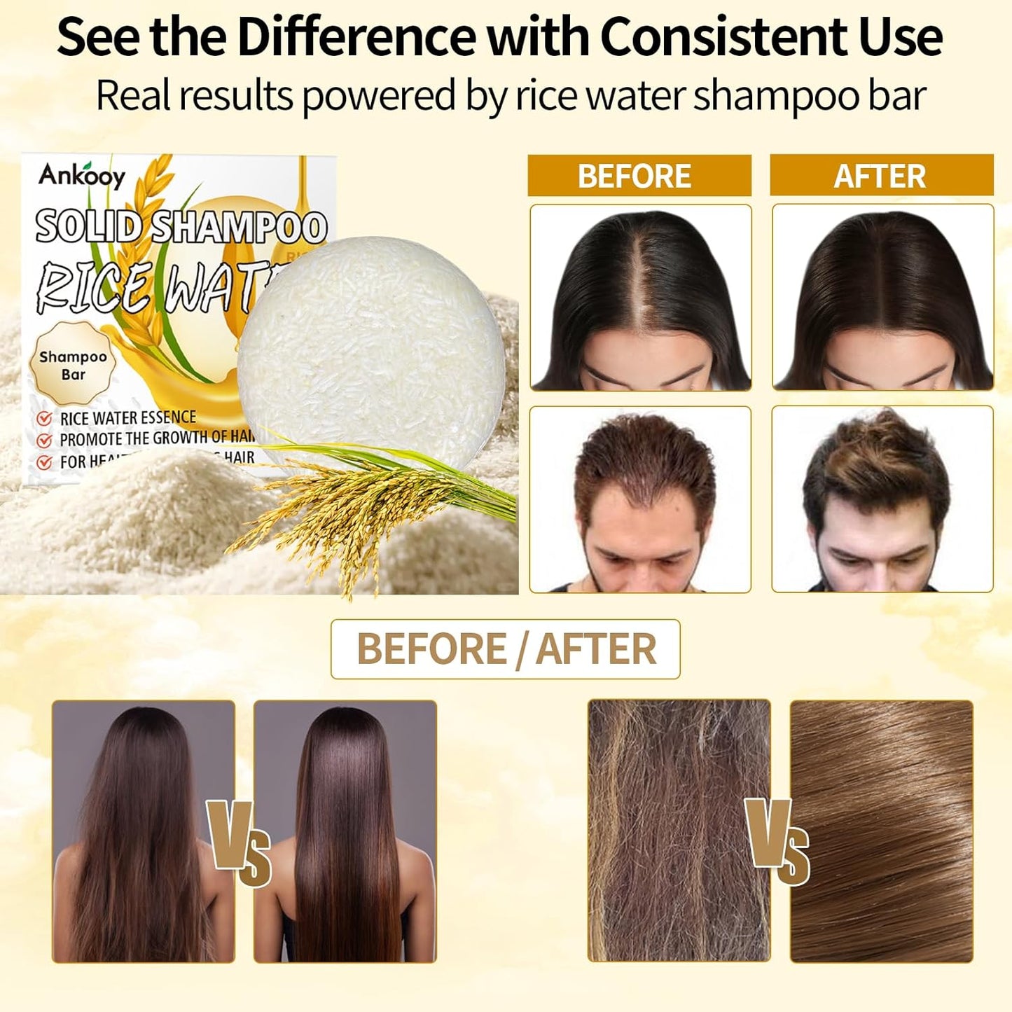 2 Pack Rice Water Shampoo Bar,Rice Shampoo Bars for Hair Growth,Dry Hair Shampoo Soap for Hair Care,Solid Soap for Women and Mens,Moisturizing for All Hair Types