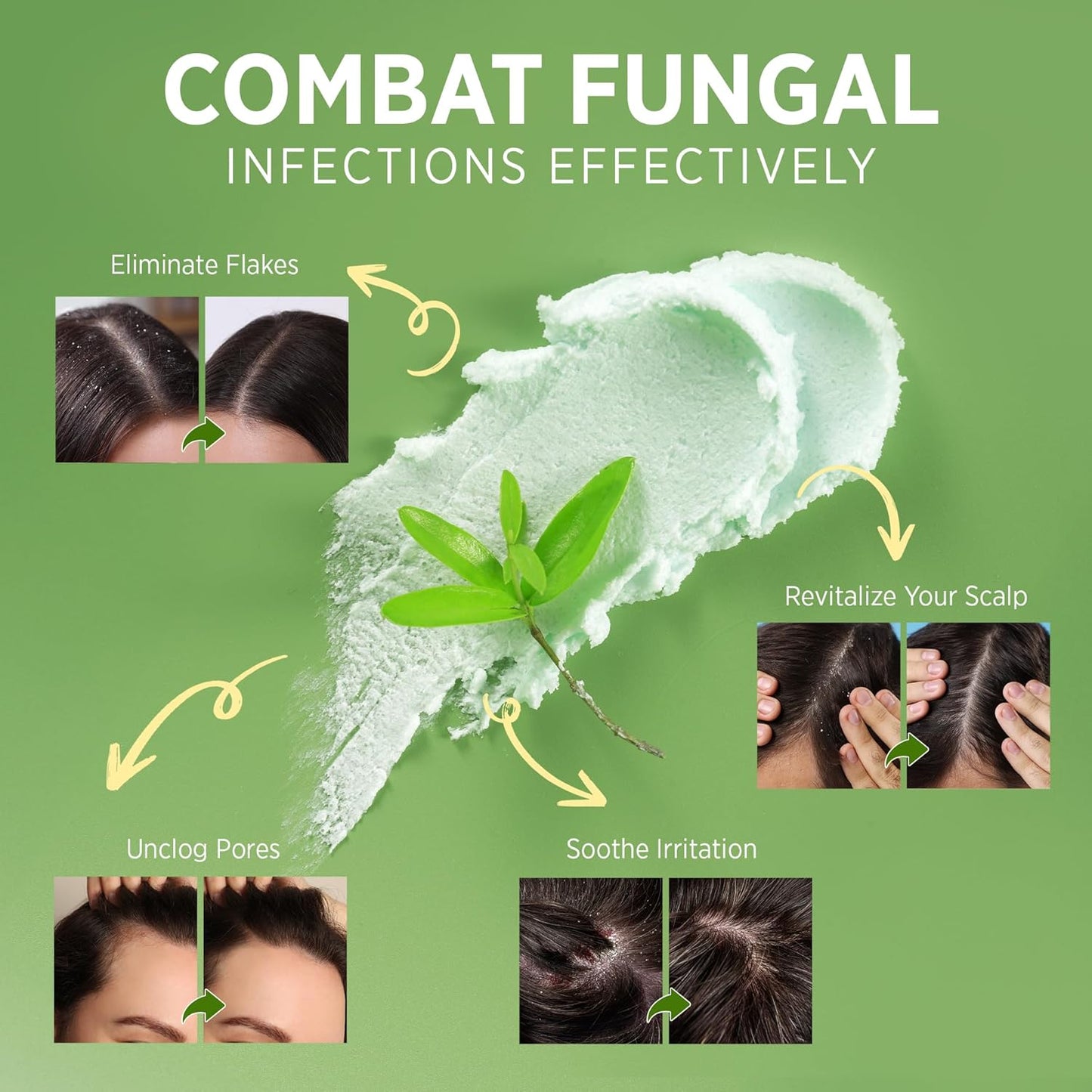 Roycederm Tea Tree Scalp Scrub: Anti Fungal Pre Shampoo, Itchy Relief Scalp Treatment for Dandruff, Psoriasis & Seborrheic Dermatitis - Gently Exfoliator, Relieves Dryness, Promotes Hair Growth