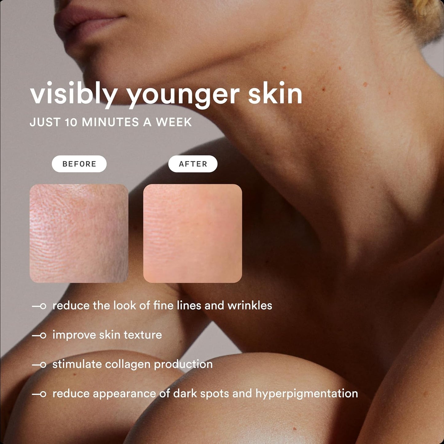 NEW Nood™ Flasher Pro — IPL Laser Hair Removal Device for Women & Men with Sapphire Cooling — Pain-free & Permanent, Visible Results After First Use & Works Everywhere Hair Grows — Gloss White