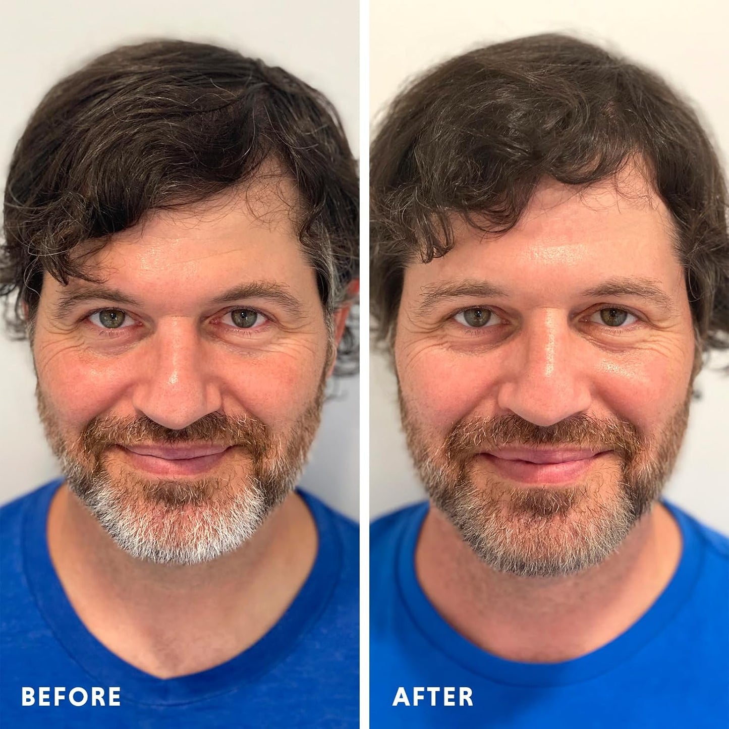 Hair & Beard Color for Blending Grays 2 pack - Medium Ash Brown - Ammonia-Free Complete Men’s At-home Beard & Hair Dye Kit, Professional-grade Demi-Permanent Hair Color (5.1)