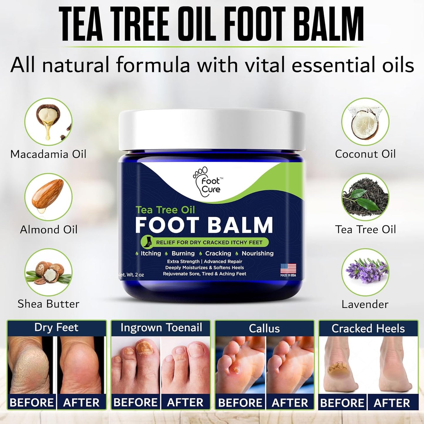 Tea Tree Oil Balm – Moisturizer for Dry Cracked Feet – Instantly Hydrates & Soothes Irritated Skin & Athlete's Foot – Best Care for Women and Men – Made in USA
