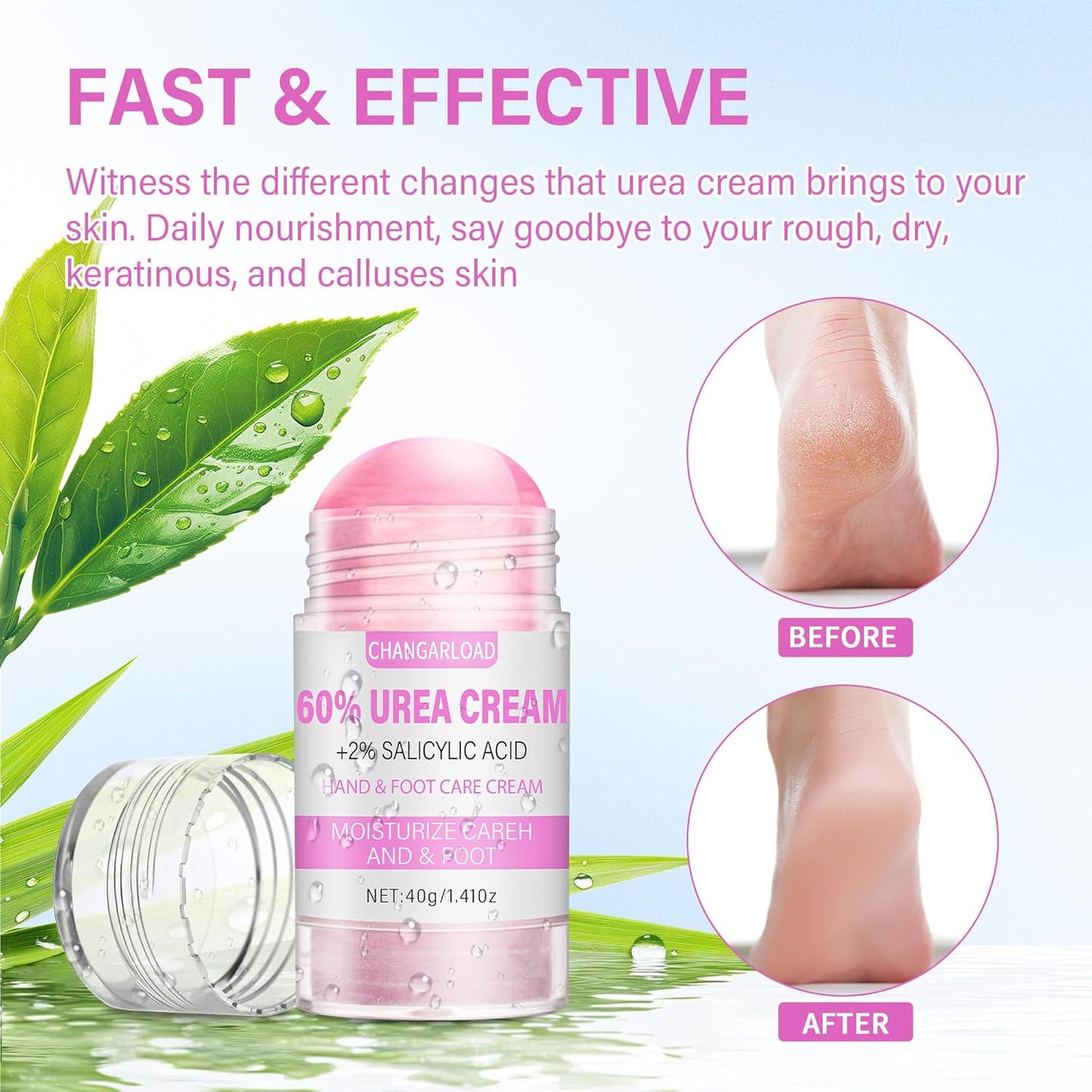 Urea Cream 60 Percent For Feet Maximum Strength - Intensive Repair Dry Cracked Skin, Urea Cream For Feet, Foot Cream For Dry Cracked Heels, 1 Pcs - 1.43 Oz