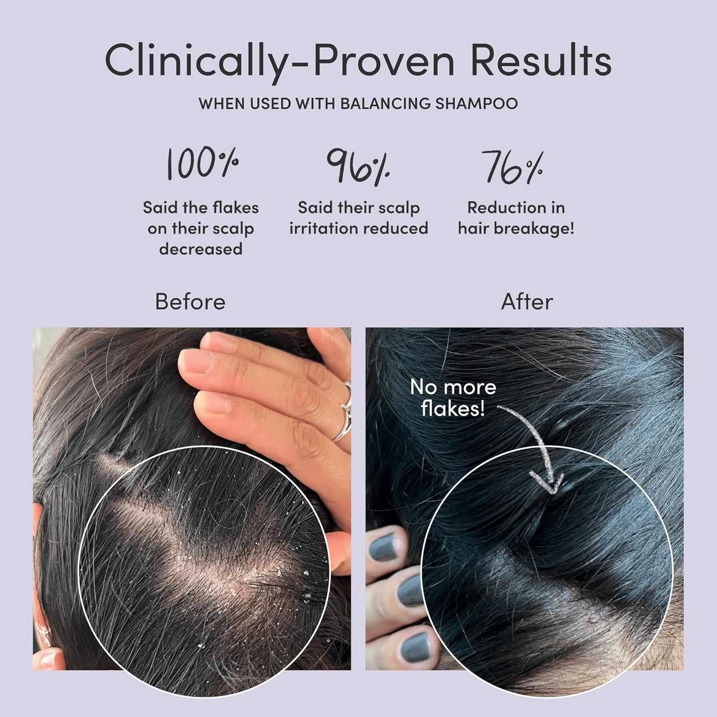 Jupiter Scalp Mask, Volcanic Ash for Exfoliation and Oil Absorption, Weekly Reset for Dry Itchy Scalp, Color Safe, Sulfate-Free, Vegan, Natural Fragrance, Unisex, 0.14 kg, 5 fl oz