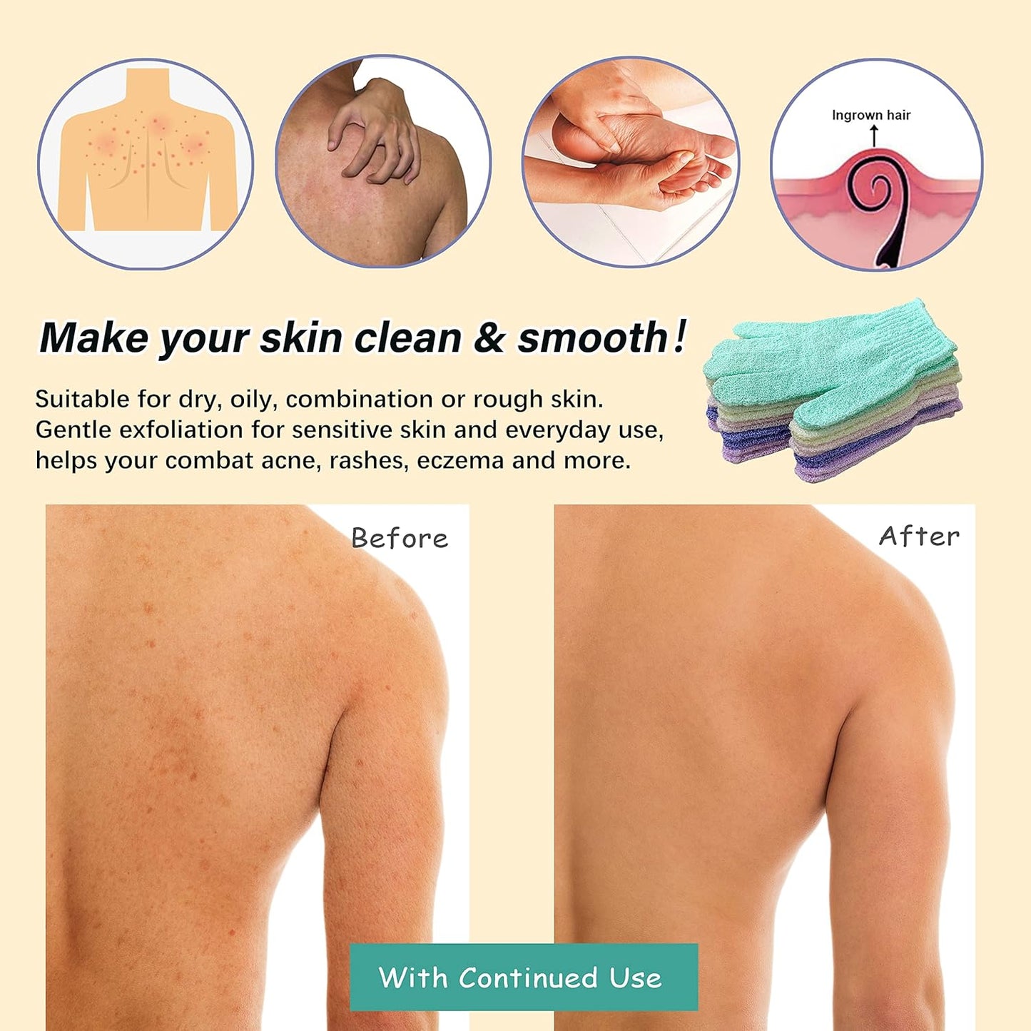 MIG4U Shower Exfoliating Scrub Gloves, Bathing Gloves Body Wash Dead Skin Removal Deep Cleansing Sponge Loofah for Women Men