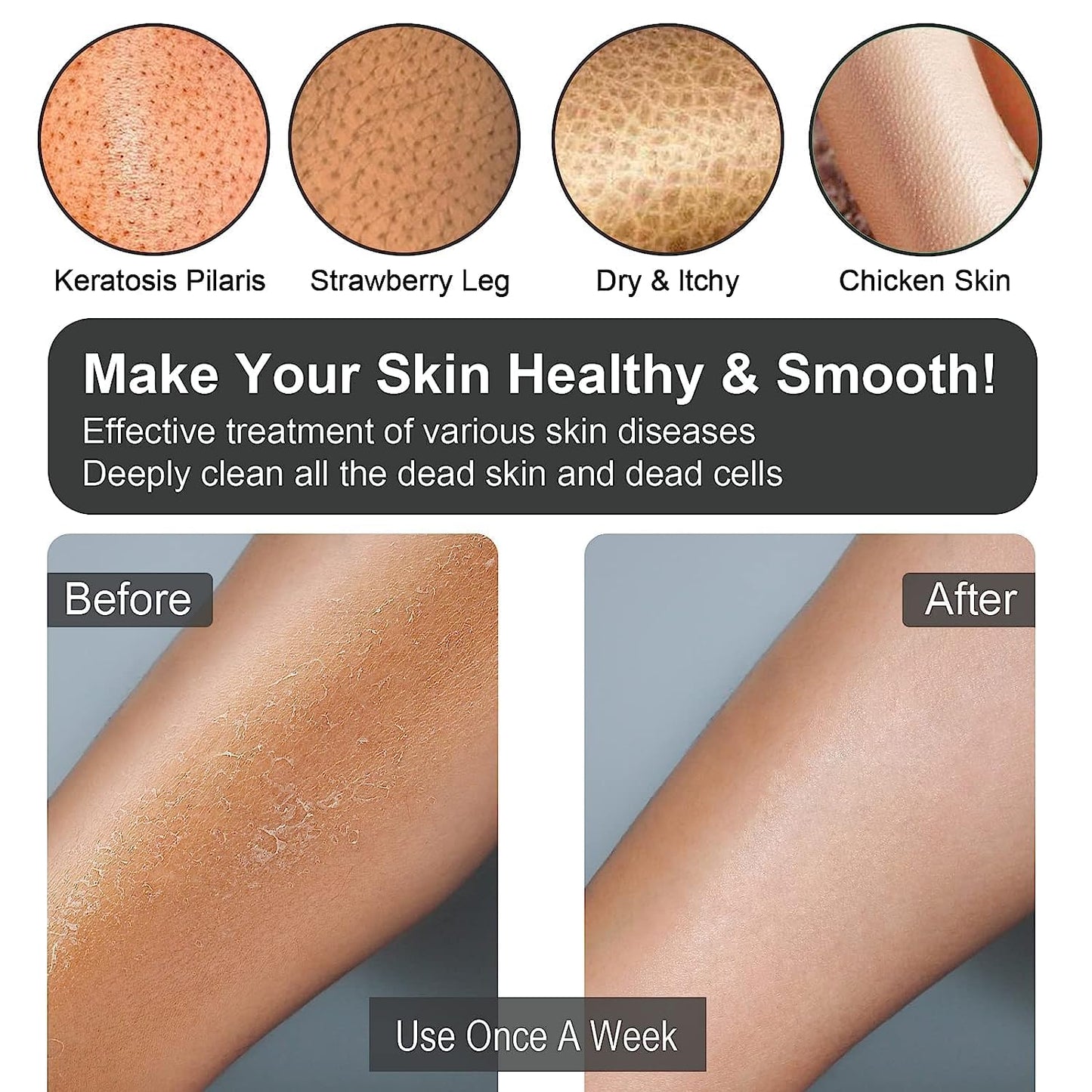 Yiclick Heavy Exfoliating Gloves, Exfoliating Body Scrubber for Bath Shower Exfoliation, Body Scrub Exfoliator For Dead Skin Remover, Exfoliate Sponge Loofah Washcloth Mitt Men Women (12 Grey)