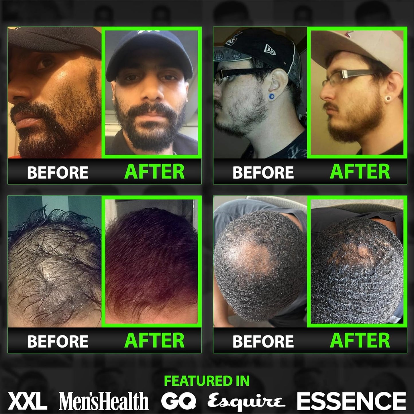 GROW Hair & Beard Wash 11-in-1 – Beard Wash & Conditioner + Beard Growth Shampoo with Biotin, Castor Oil, Peppermint, Keratin – Supports Hair & Beard Growth