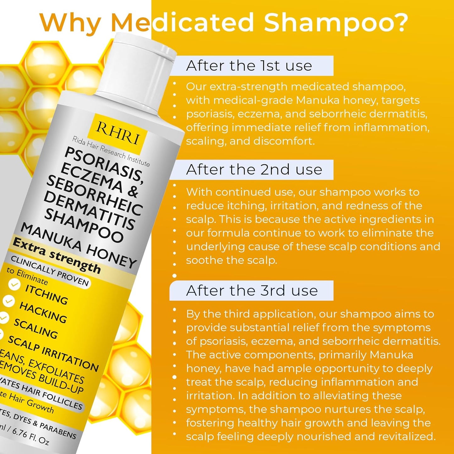 Antifungal Psoriasis Shampoo, Eczema, Seborrheic Dermatitis Shampoo | Soothes Itching, Flaking & Irritation | Repairs Scalp, Strengthens Hair, Stimulates Regrowth | Medicated Scalp Treatment